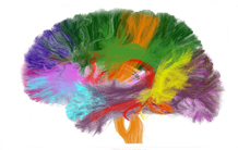Dossier sur l'imagerie médicale